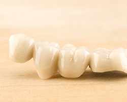 Closeup of custom-made dental bridge in Dallas