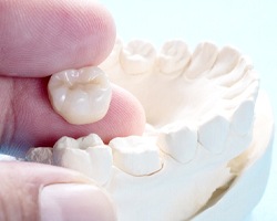 dentist holding dental crown in Dallas by model teeth