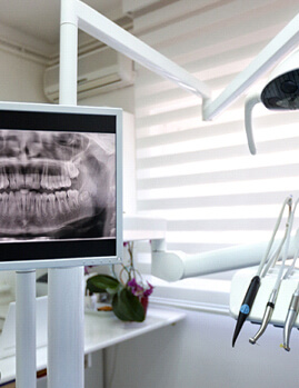 Digital X-Ray displayed on monitor in dental treatment room