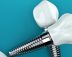 closeup of dental implants in Dallas, GA on blue background