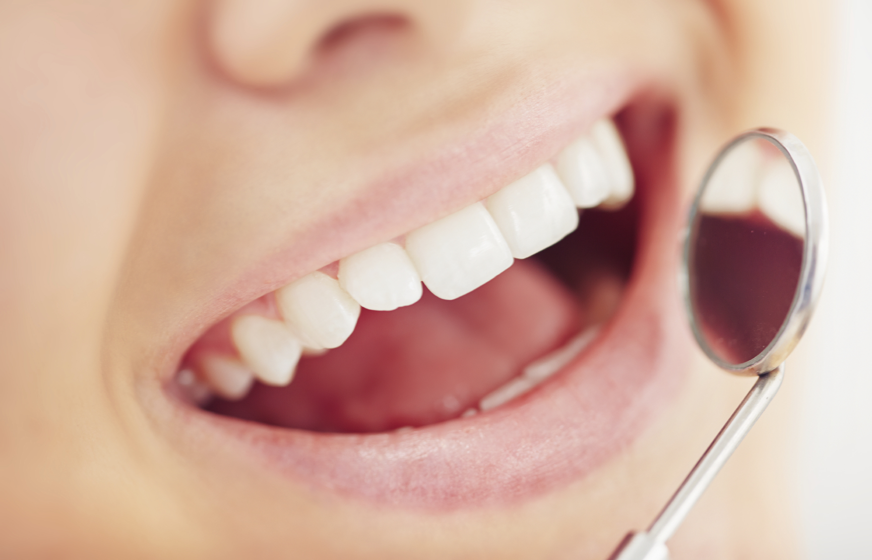 Your Dentist in Dallas, GA, Discusses the Signs of Gingivitis