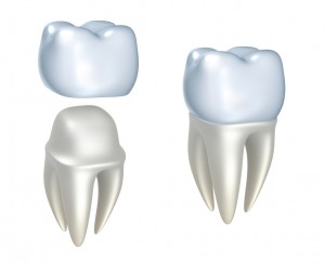 Porcelain crowns in Hiram, GA from Distinctive Dentistry can give you the healthy grin you’ve been longing for. 
