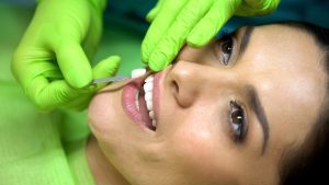 Woman having porcelain veneers attached 