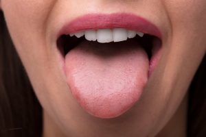 normal tongue coating