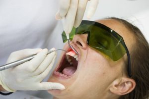 a person receiving laser gum recontouring