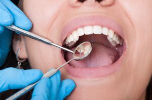 Dentist using little mirror to examine patient’s teeth.